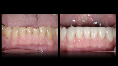 Dentist. Dr W Van Wyk showcase 1